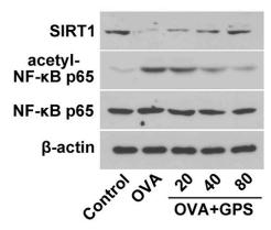 NF-kB p65 Antibody - Fig.