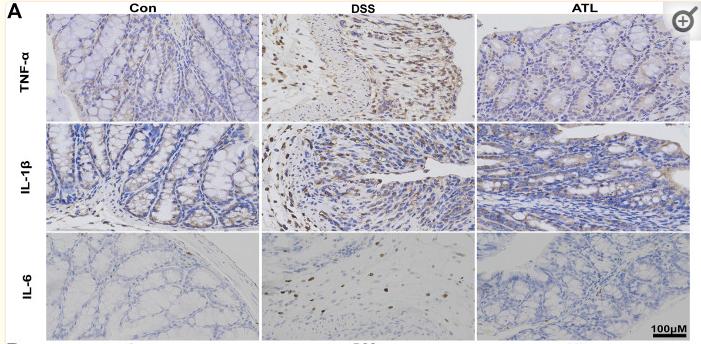 TNF alpha Antibody - FIGURE 3
ATL attenuates intestinal inflammation of DSS-induced colitis in mice (A) Immunohistochemistry of inflammatory cytokines (TNF-α, IL-6, and IL-1β) (B) Immunofluorescent staining of macrophages (F4/80, iNOS) (C) Representative western blots of p-p38, p38, p-JNK, JNK, p-ERK, and ERK in colon tissue (D–F) Relative density of each signaling band was calculated.