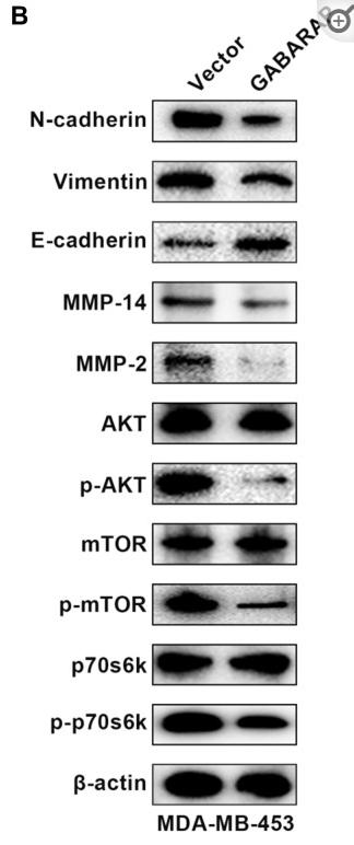 Phospho-mTOR (Ser2448) Antibody - Figure 3
Low GABARAP level promotes cellular EMT via AKT/mTOR signaling in breast cancer.