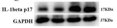 Cleaved-IL-1 beta (Asp116) Antibody - Fig.