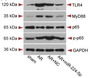 NF-kB p65 Antibody - Fig.