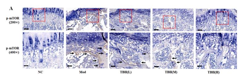 Phospho-mTOR (Ser2448) Antibody - Fig.