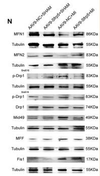Phospho-DRP1 (Ser616) Antibody - Figure 4
Sfrp5 decreased apoptosis and improved mitochondrial dysfunction.