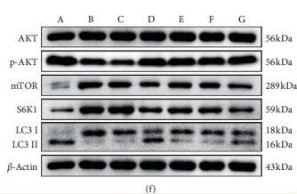 mTOR Antibody - Figure 5
The expressions of Akt, p-Akt, mTOR, S6K1, LC3I, and LC3II in the kidney tissues of rats detected by western blotting.