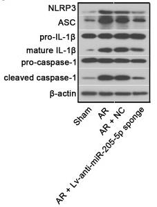 IL1 beta Antibody - Figure 4.