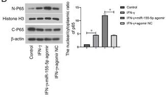 NF-kB p65 Antibody - Figure 4
miR-155-5p activates the NF-κB signaling pathway in IFN-γ-treated SGECs.