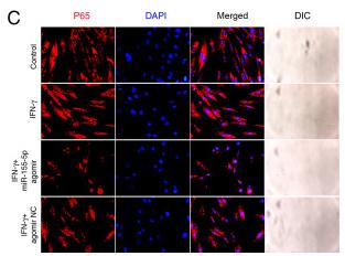 NF-kB p65 Antibody - Figure 4
miR-155-5p activates the NF-κB signaling pathway in IFN-γ-treated SGECs.