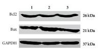 Bcl-2 Antibody - Figure 3
Effect of miR-128 knockdown on cardiomyocytes apoptosis induced by Ang II.
