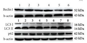 Beclin 1 Antibody - Figure 5
Effect of miR-128 downregulation on Ang II-induced autophagy.