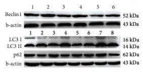LC3A/B Antibody - Figure 5
Effect of miR-128 downregulation on Ang II-induced autophagy.