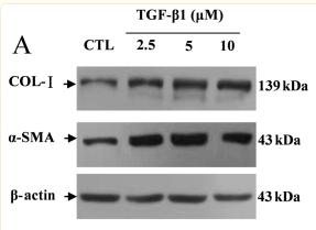 Collagen I Antibody - Figure 1.