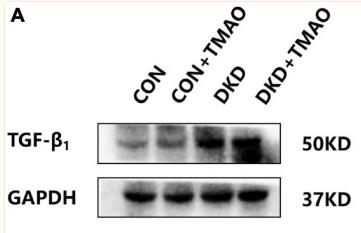 TGF beta 1 Antibody - FIGURE 5
Expression of renal fibrosis proteins in the kidney of rats.