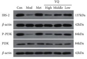 PI3K p85 alpha Antibody - Figure 11
Effect of YQ on insulin secretion-related proteins in pancreas islet.