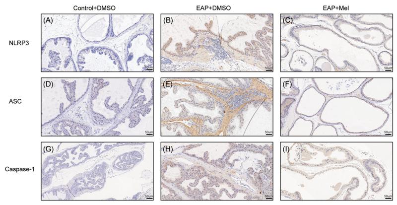 Cleaved-Caspase 1 (Asp296), p20 Antibody - FIGURE 3 Melatonin decreased the expression of NLRP3 inflammasome‐related proteins in the EAP mice model.