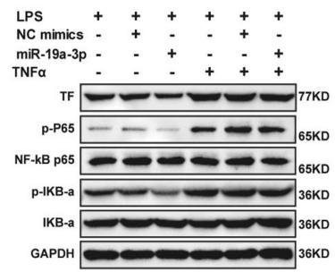 NF-kB p65 Antibody - Fig.