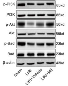 PI3K p85 alpha Antibody - Fig.