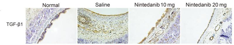 TGF beta 1 Antibody - Fig.