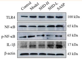 NF-kB p65 Antibody - Fig.
