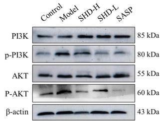 PI3K p85 alpha Antibody - Fig.