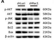 Phospho-AKT1/2/3 (Ser473) Antibody - Figure 3
shRac1 and shP67 transfection reduce cell death/apoptosis.