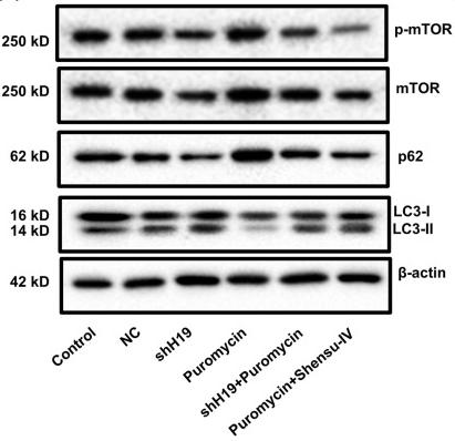 Phospho-mTOR (Ser2448) Antibody - Figure 9
Treatment with shH19 or Shensu IV promoted autophagy in puromycin-induced injury in podocytes
(A) Representative blots of mTOR, p62, and LC3.
