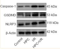 Caspase 1 Antibody - Figure 6
Effect of HPC on the expression of caspase-1, GSDMD, and NLRP3 in the brains of cerebral I/R injury model mice.