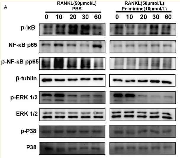 ERK1/2 Antibody - Figure 6
Peiminine interferes with the NF-κB and ERK1/2 pathways.
