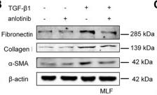 Collagen I Antibody - FIGURE 1
Anlotinib represses myofibroblast activation and the profibrogenic phenotype in vitro.