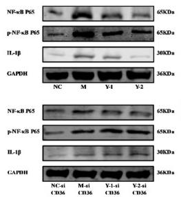 NF-kB p65 Antibody - Figure 4
Effects of Y-1 and Y-2 on NRK-52e cells’ inflammatory cytokines stimulated by sodium oleate with/without CD36 silences representative.