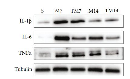 IL6 Antibody - Figure 4:| TT inhibited the inflammatory activation of microglia and astrocytes.