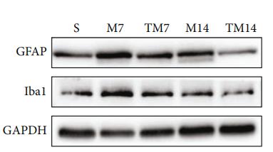 GAPDH Antibody - Figure 4:| TT inhibited the inflammatory activation of microglia and astrocytes.