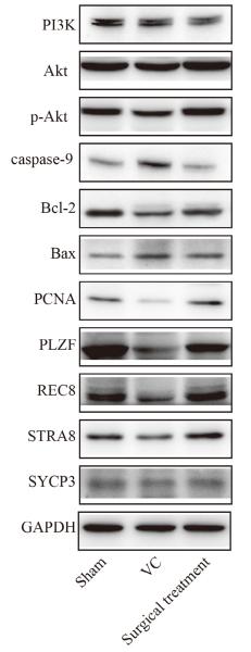 Phospho-AKT1/2/3 (Ser473) Antibody - FIGURE 13| Validation of regulated signalling pathways, spermatogenic cell apoptosis and proliferation, and meiotic spermatocytes by Western blot.
