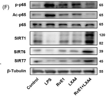 NF-kB p65 Antibody - FIGURE 2 | Effects of the RvE1 and LXA4 combination on NF-κB modification.
