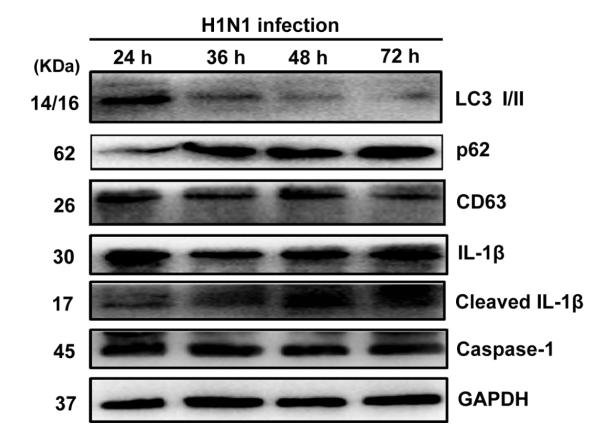GAPDH Antibody - FIGURE s4 |The total proteins of infected primary peritoneal macrophages were extracted at 24, 36, 48, and 72 h post-infection and then subjected for Western blotting.