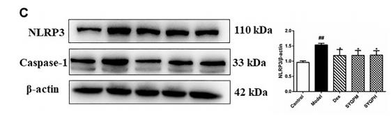 NLRP3 Antibody - FIGURE 9 | SYQP inhibited the activation of TNF-α and IFN-γ induced inflammatory death.