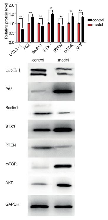 LC3A/B Antibody - Figure 1.
