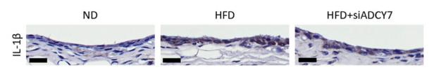 IL1 beta Antibody - Fig.