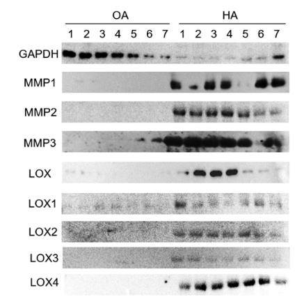MMP2 Antibody - Figure 5.
