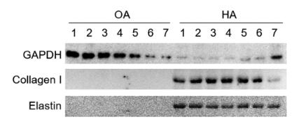 Collagen I Antibody - Figure 6.