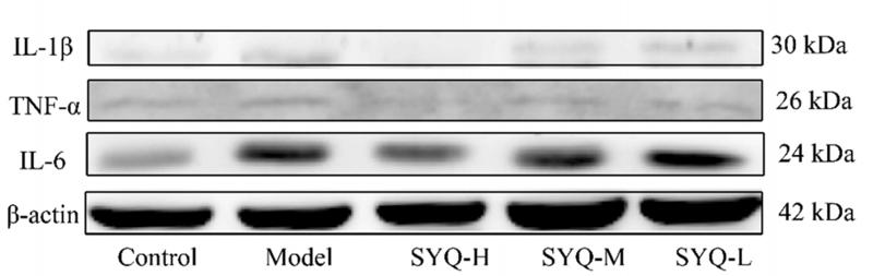 IL1 beta Antibody - Fig.