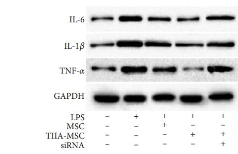 TNF alpha Antibody - Figure 3:| Inflammatory factor (IL-1β, IL-6, and TNF-α) protein expression.