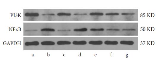 PI3K p85 alpha Antibody - Figure 12|The protein expression levels of TNF-α, IL-6, MMP9, MAPK8, PI3K, NF-κB, and IκBα in blood (n = 3).