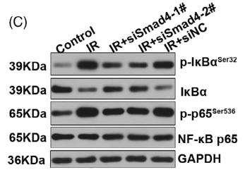 NF-kB p65 Antibody - FIGURE 4| The deficiency of Smad4 inhibited the inflammatory response in a cellular model of human insulin resistance.