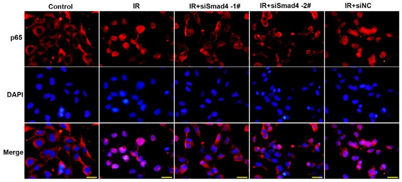 NF-kB p65 Antibody - FIGURE 4| The deficiency of Smad4 inhibited the inflammatory response in a cellular model of human insulin resistance.