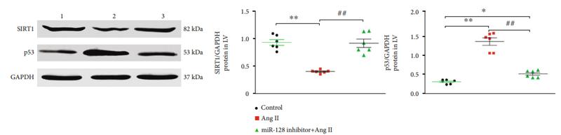 SirT1 Antibody - Figure 4: |Silencing miR-128 attenuates AngII-induced apoptosis through SIRT1/p53 pathway.