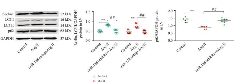 Beclin 1 Antibody - Figure 5:| Effect of miR-128 downregulation on Ang II-induced autophagy.