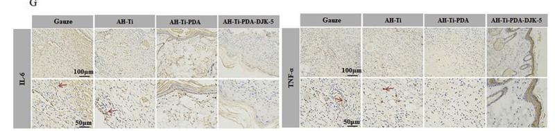 IL6 Antibody - Fig.