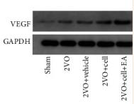 VEGFA Antibody - Figure 6
EA facilitates hippocampal angiogenesis in 2VO+Cell rats.