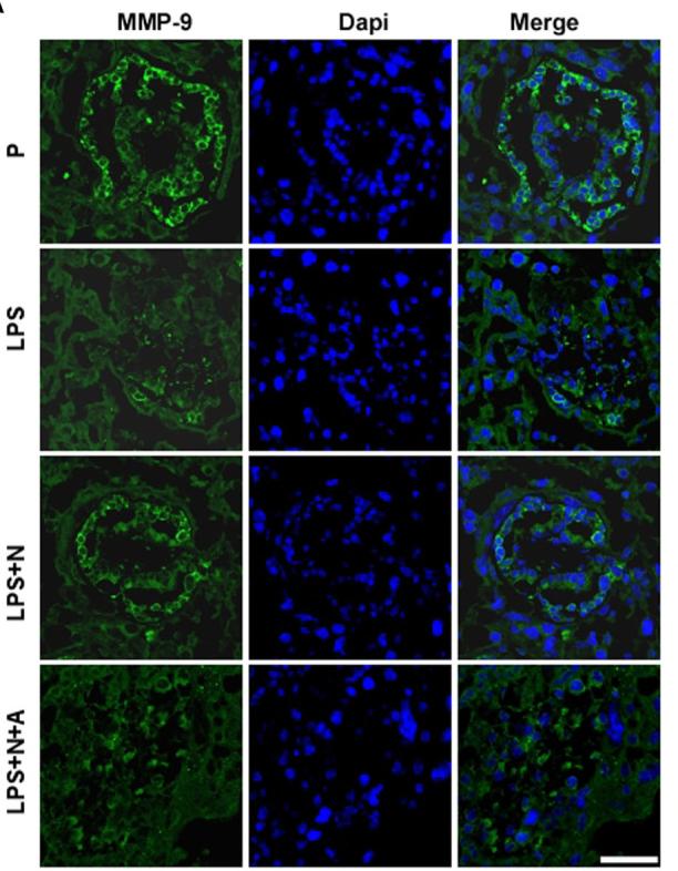 MMP9 Antibody - Figure 4
Nicotine up-regulated the decreased MMP-9 expression in placentas from LPS-induced PE-like mice.