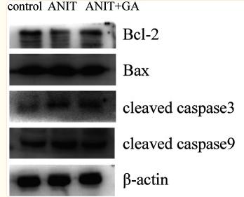 Cleaved-Caspase 9 (Asp353) Antibody - FIGURE 7
Effects of GA on the expression of the apoptotic signaling pathway (n = 6).